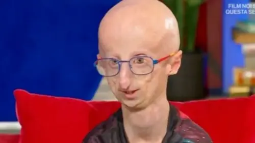 Sammy Basso a Oggi è un altro giorno fa commuovere tutti