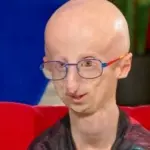 Sammy Basso a Oggi è un altro giorno fa commuovere tutti