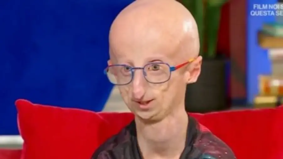 Sammy Basso a Oggi è un altro giorno fa commuovere tutti