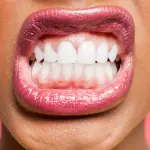 Come sbiancare i denti a casa con rimedi naturali